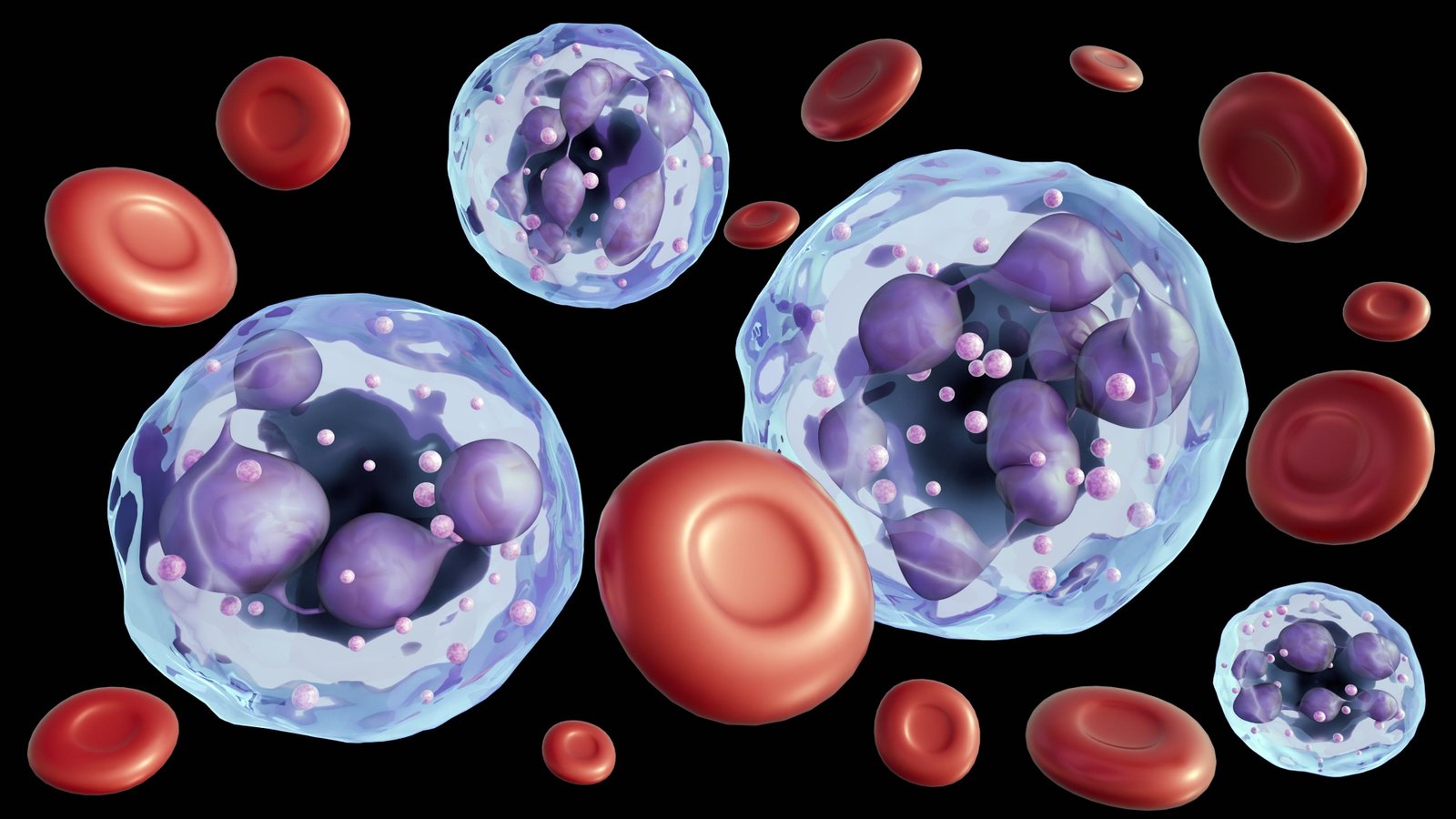 Megaloblastic anemia