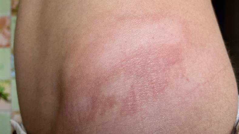 Integumentary System