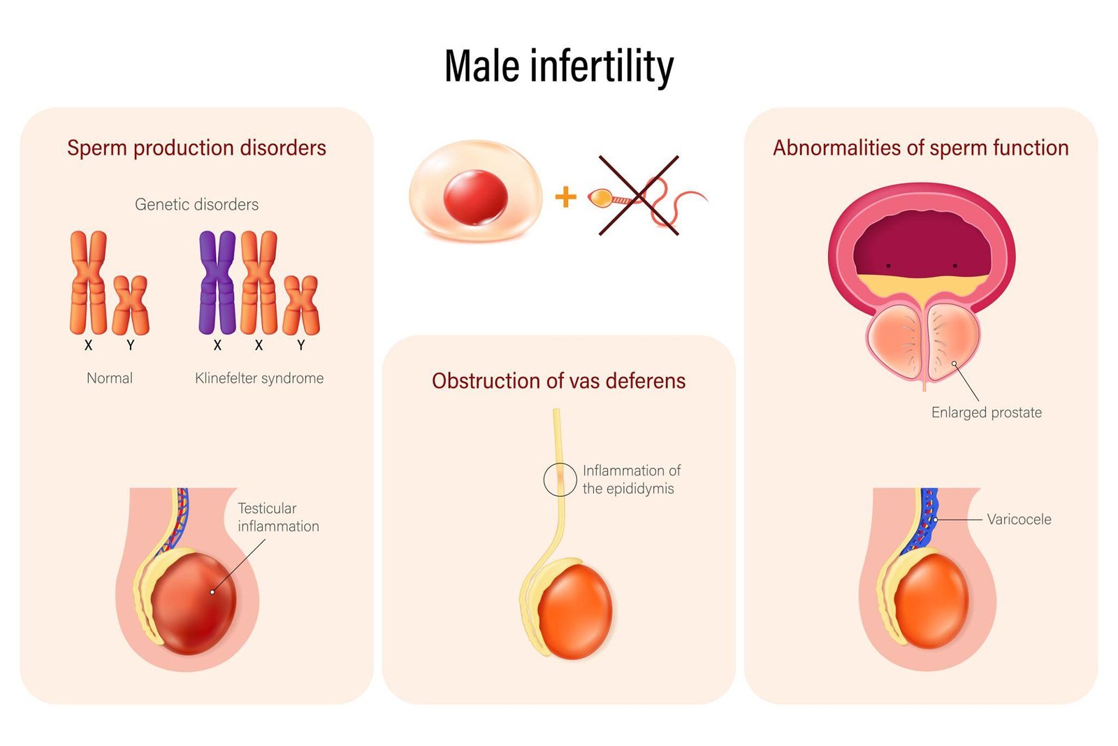Infertility