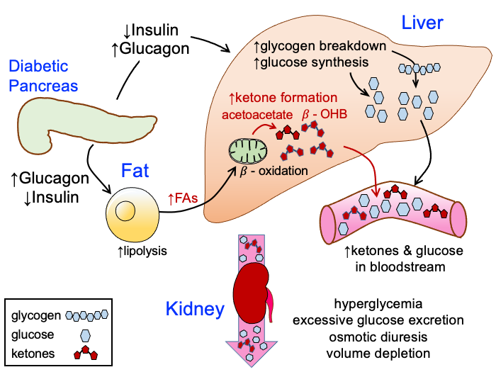 Diabetic ketoacidosis (DKA)